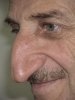 Mehmet Ozyurek - Biggest nose 04.jpg